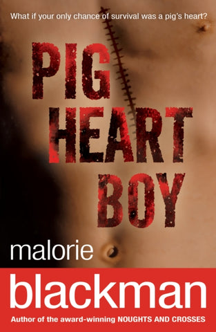 Pig Heart Boy-9780552551663